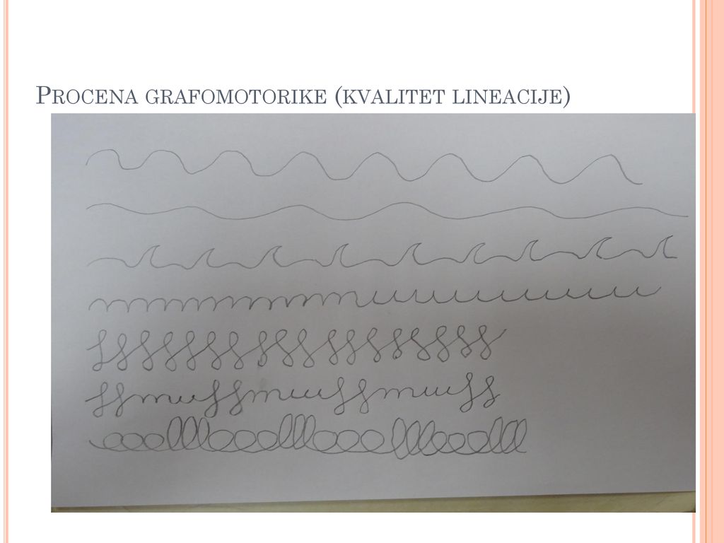 Procena grafomotorike (kvalitet lineacije)